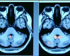 地平线系列：记忆的实现封面图